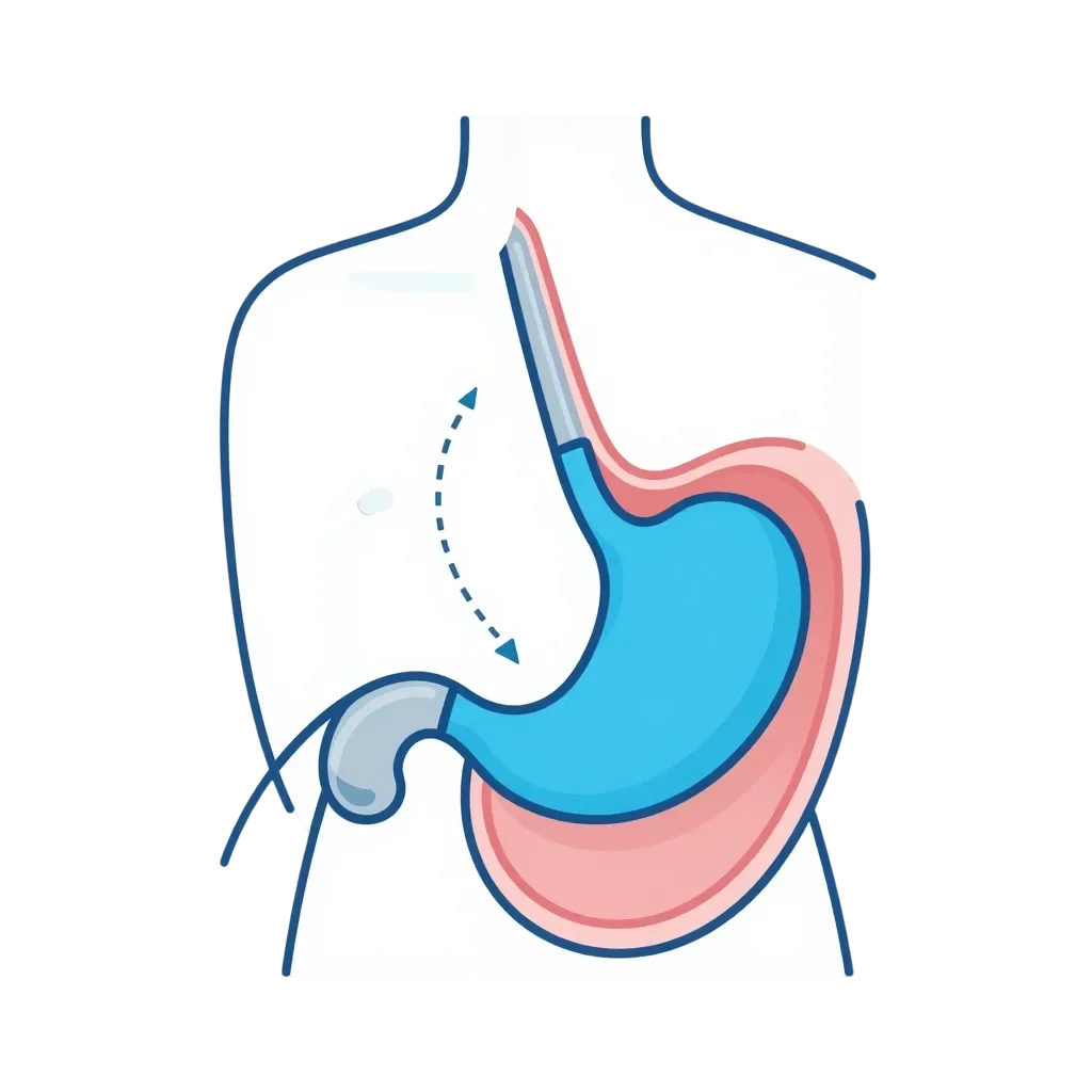 Анатомическая репозиция